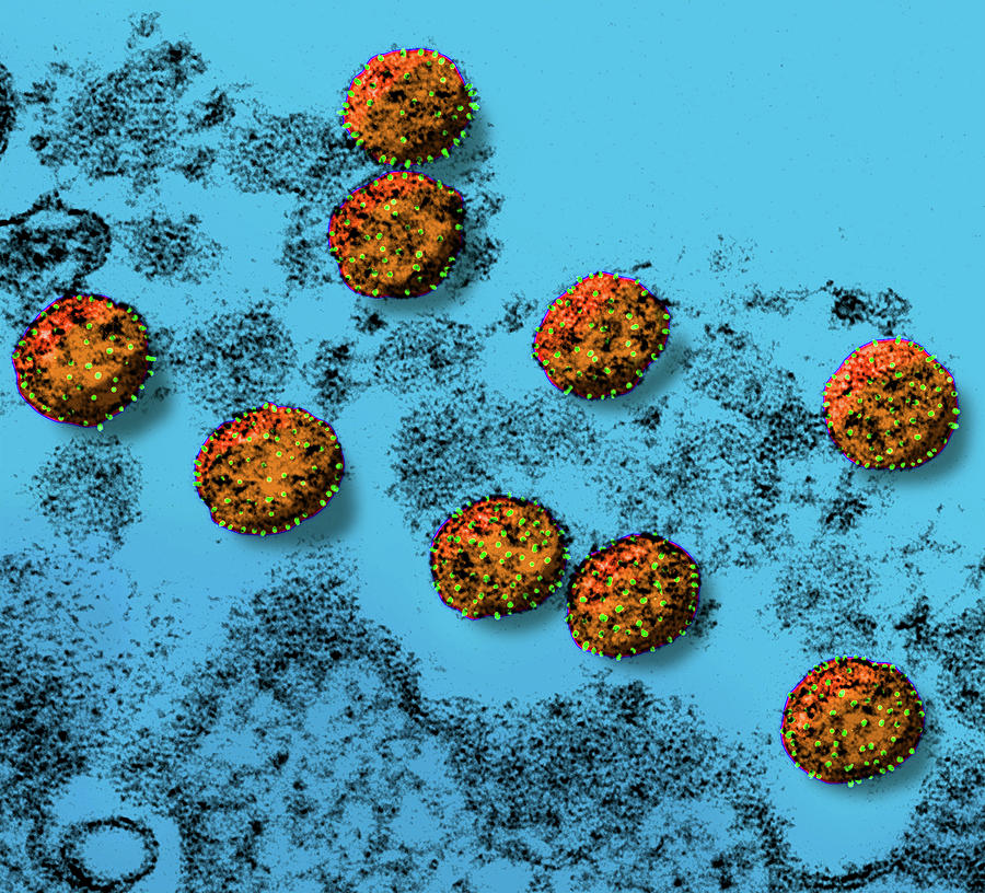 Sars-cov-2, Covid-19 Virus, Tem #43 Photograph by Science Source