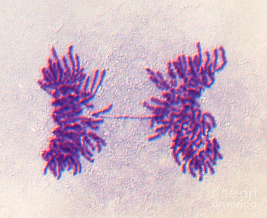 Mitosis #44 Photograph by Dr. Juan F. Gimenez-abian / Science Photo Library