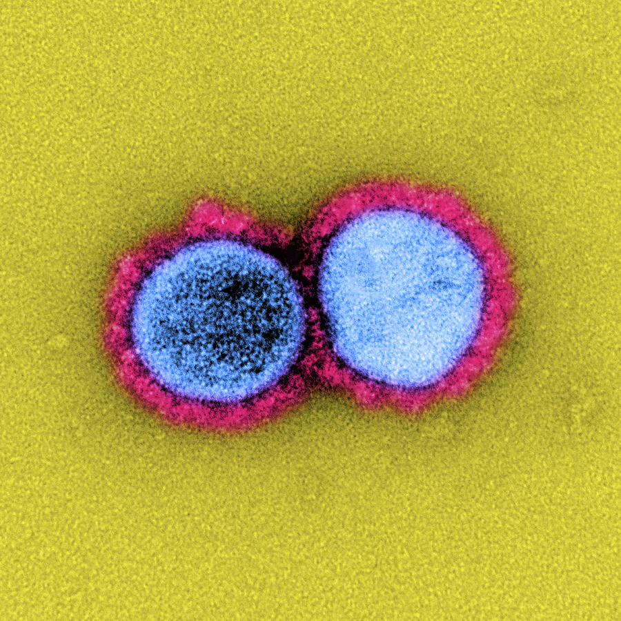 Sars-cov-2, Covid-19 Virus, Tem #44 Photograph by Science Source