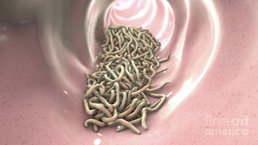 roundworms in human poop