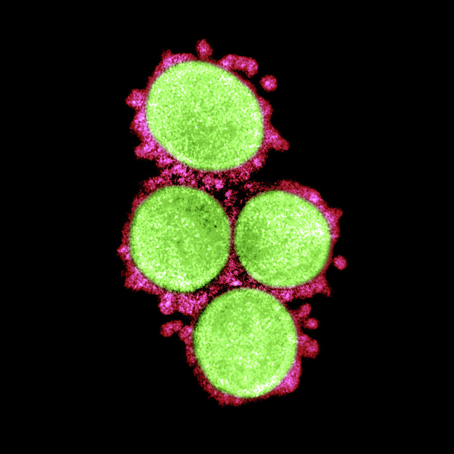 Sars-cov-2, Covid-19 Virus, Tem #45 Photograph by Science Source