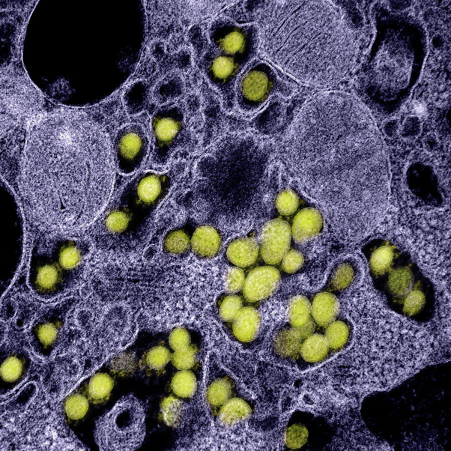 Sars-cov-2, Covid-19 Virus, Tem #46 Photograph by Science Source