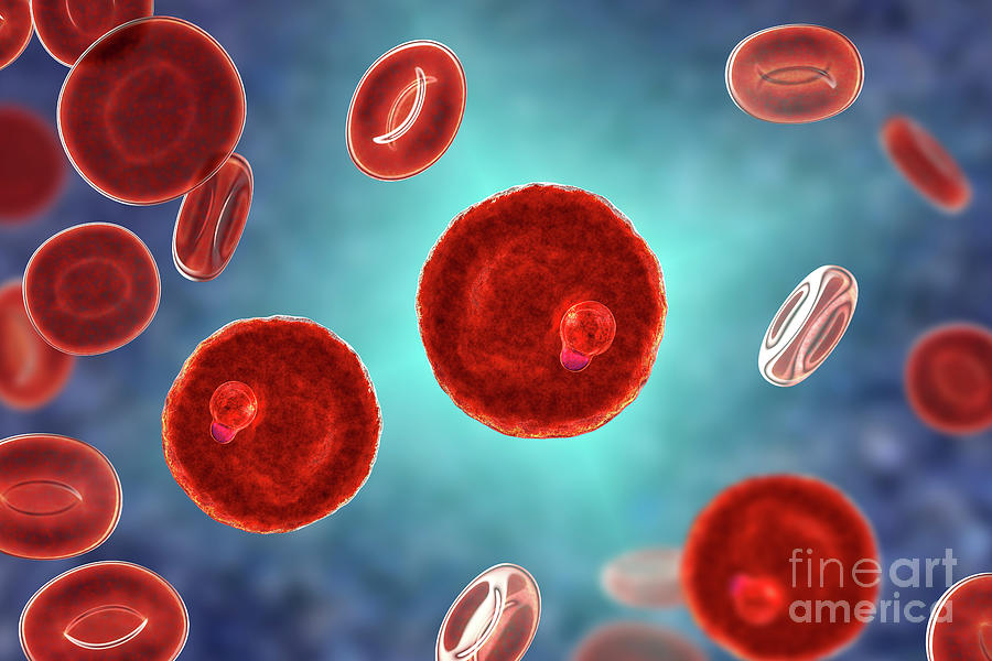 Plasmodium Malariae Inside Red Blood Cell #47 Photograph by Kateryna Kon/science Photo Library