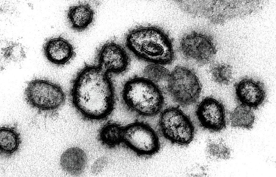 Sars-cov-2, Covid-19 Virus, Tem #47 Photograph by Science Source