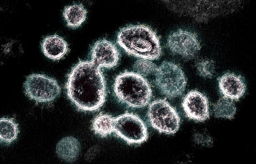 Sars-cov-2, Covid-19 Virus, Tem #48 Photograph by Science Source