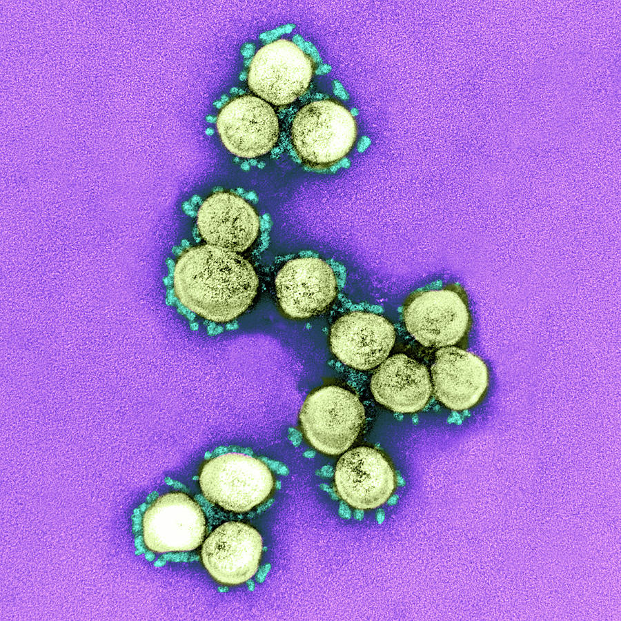 Sars-cov-2, Covid-19 Virus, Tem #49 Photograph by Science Source
