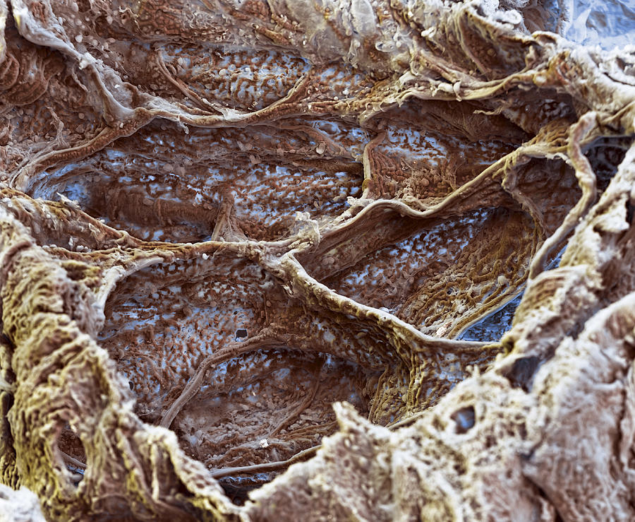 Alveoli With Capillaries, Sem #5 Photograph by Meckes/ottawa