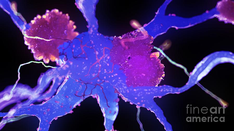 Alzheimers Nerve Cells #5 Photograph by Sebastian Kaulitzki/science Photo Library