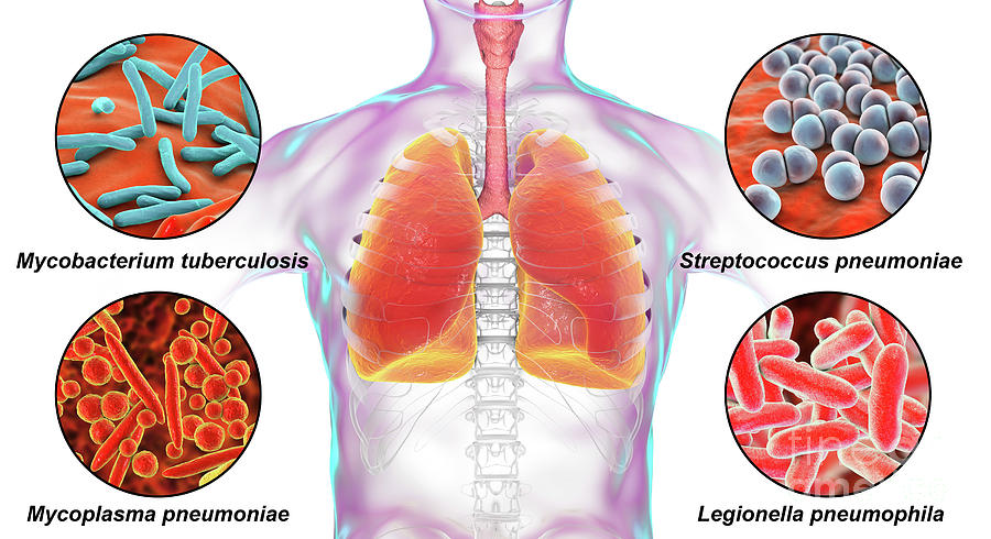 Bacteria That Cause Lung Infections Photograph By Kateryna Konscience Photo Library Pixels 0281