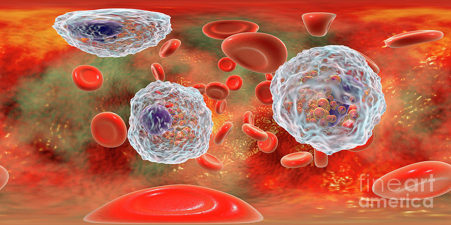 Blood Smear With Numerous Eosinophils Photograph by Kateryna Kon ...