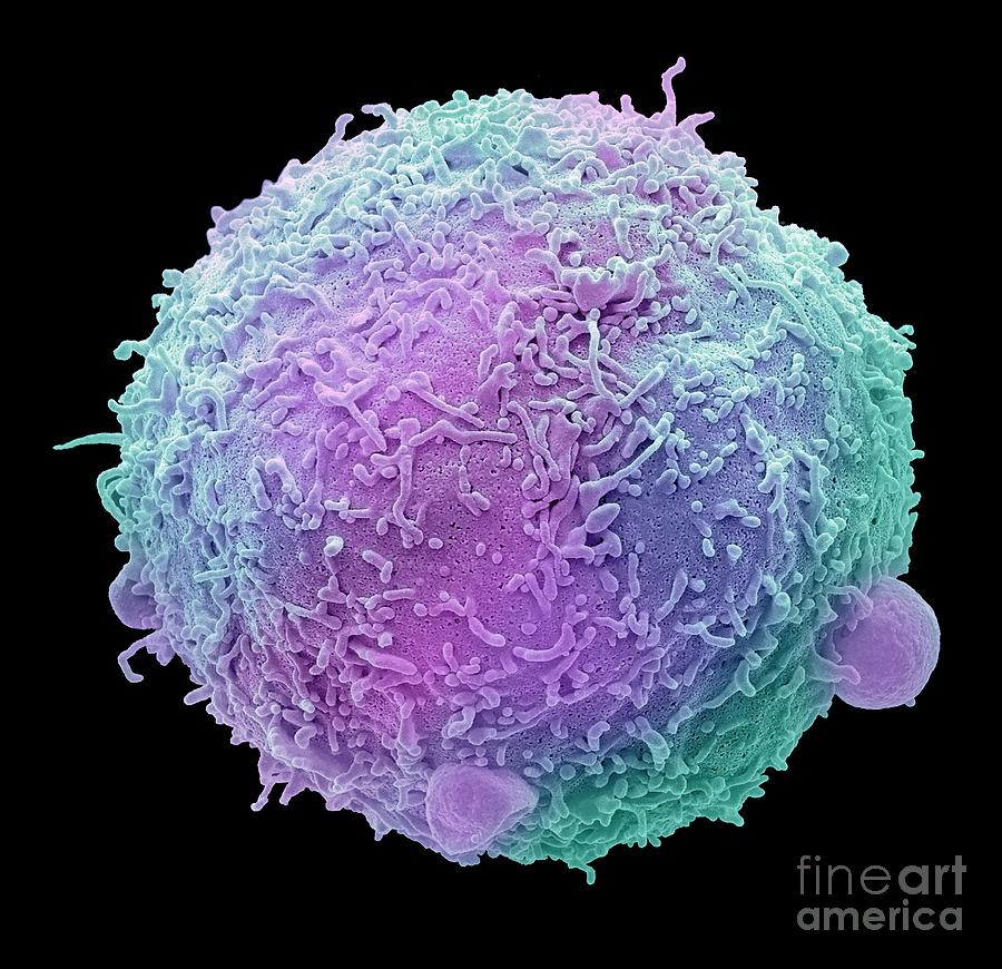 Breast Cancer Cell Photograph By Steve Gschmeissner Science Photo Library