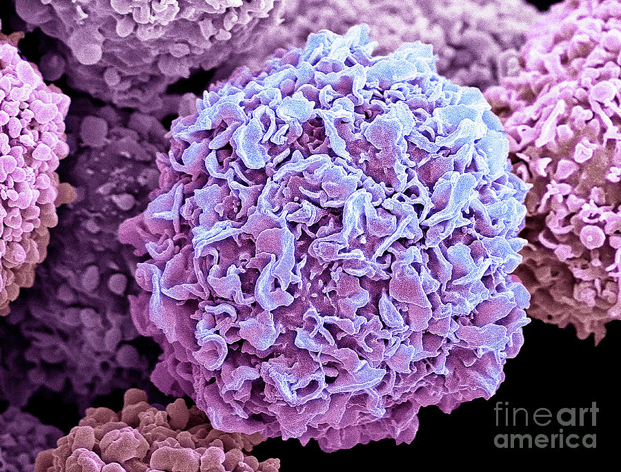 Breast Cancer Cells #5 Photograph by Steve Gschmeissner/science Photo Library
