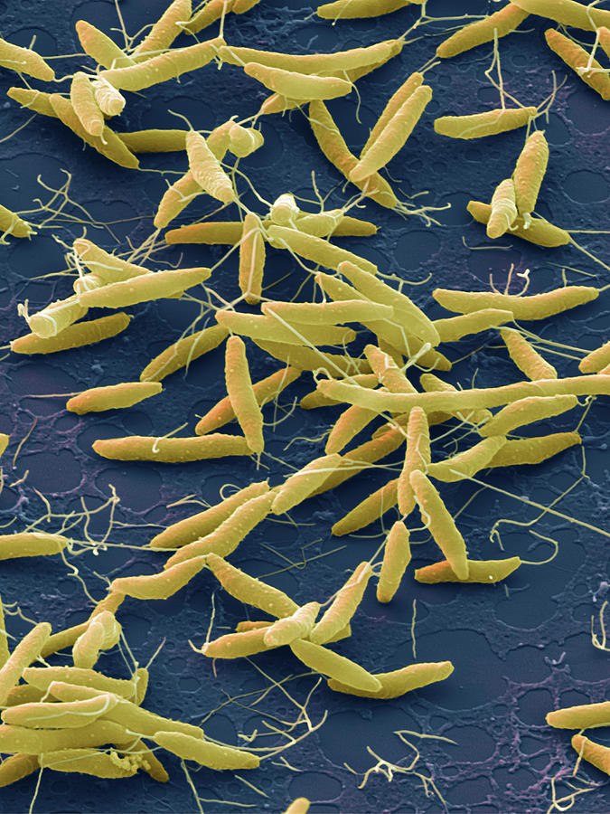 Campylobacter Jejuni, Sem #5 Photograph by Oliver Meckes EYE OF SCIENCE