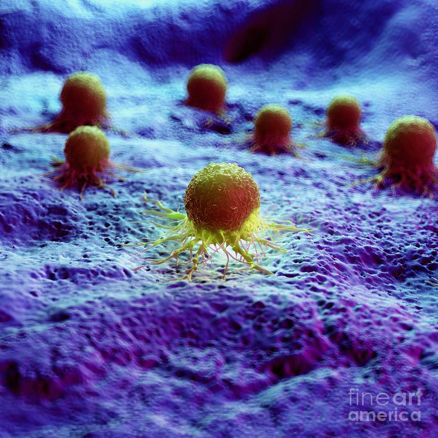 Cancer Photograph - Cancer Cells #5 by Sebastian Kaulitzki/science Photo Library