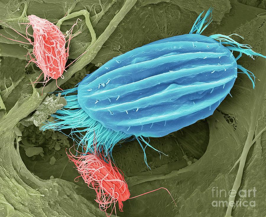 Ciliate Protozoa Photograph by Steve Gschmeissner/science Photo Library ...