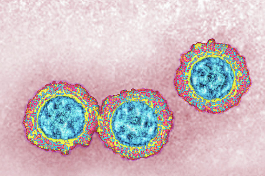 Coronavirus, Tem #5 Photograph by James Cavallini