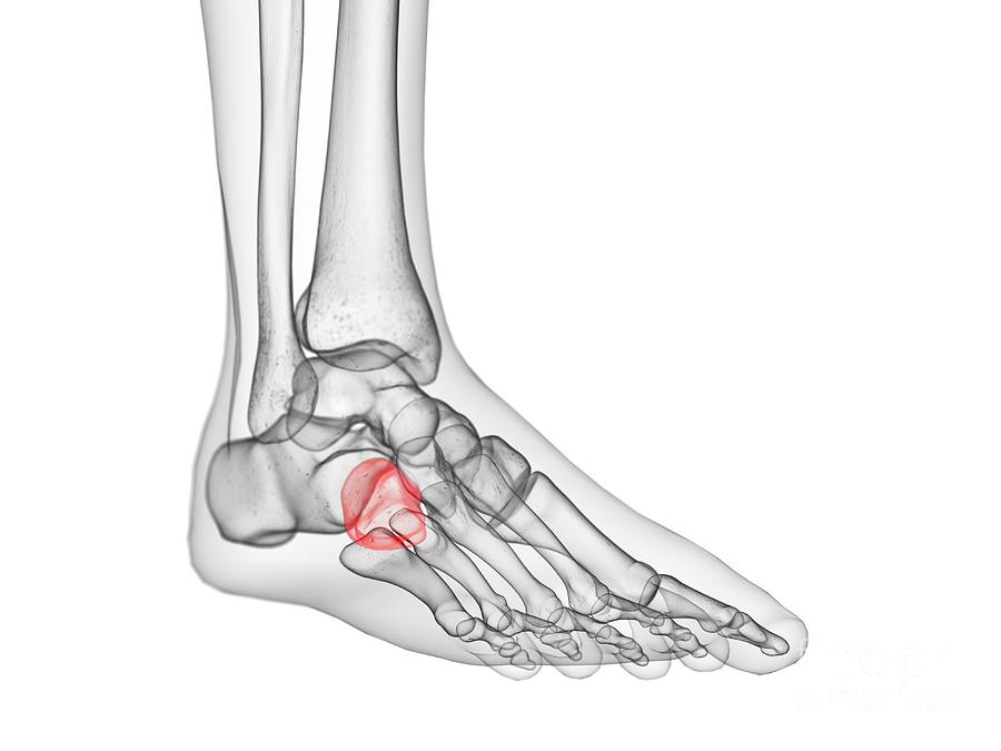 Cuboid Bone Photograph by Sebastian Kaulitzki/science Photo Library ...