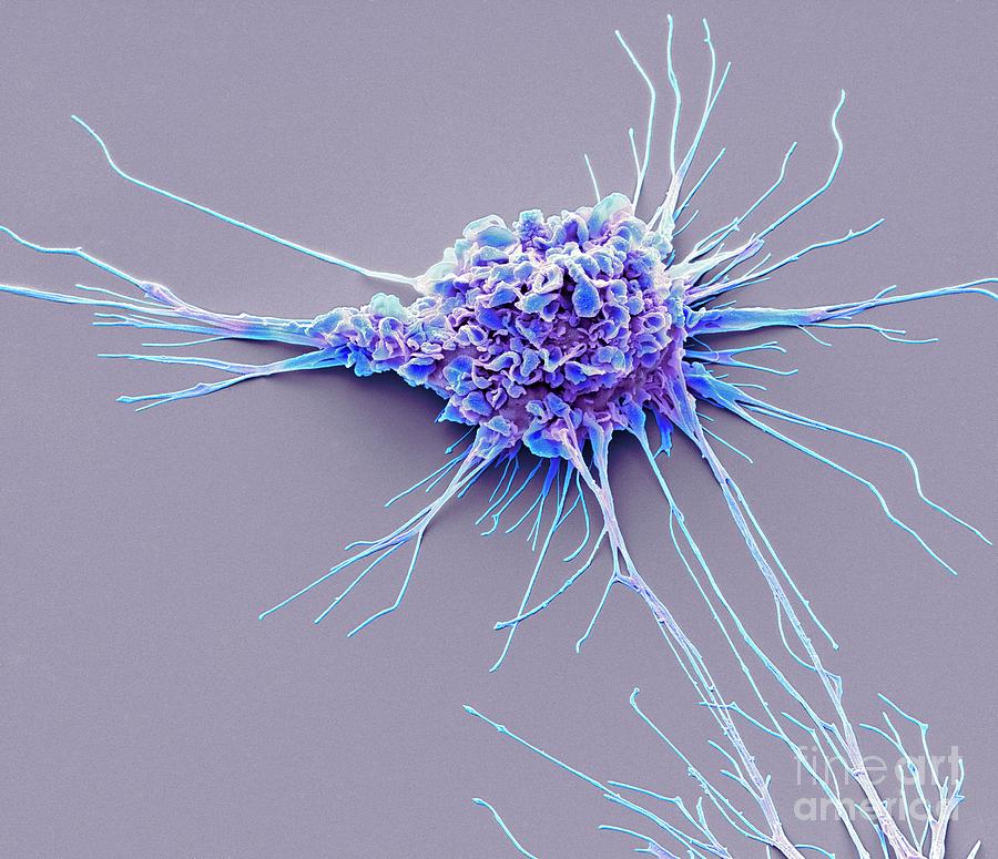 Dendritic Cell Photograph by Steve Gschmeissner/science Photo Library ...