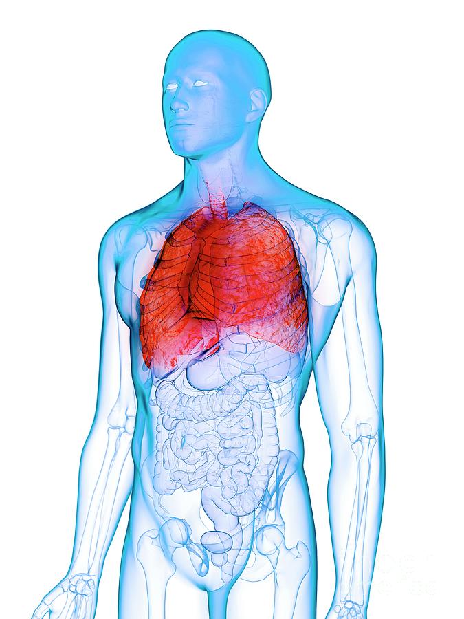 Diseased Lung #5 Photograph by Sebastian Kaulitzki/science Photo ...