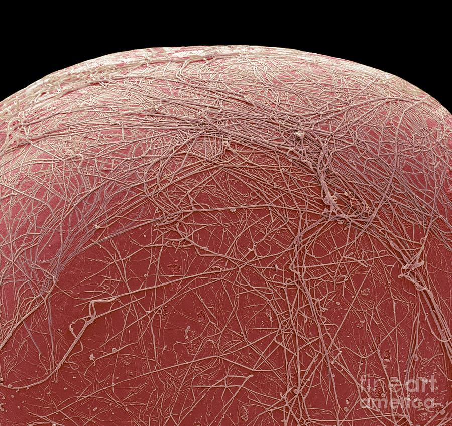 Fat Cell #5 Photograph by Steve Gschmeissner/science Photo Library