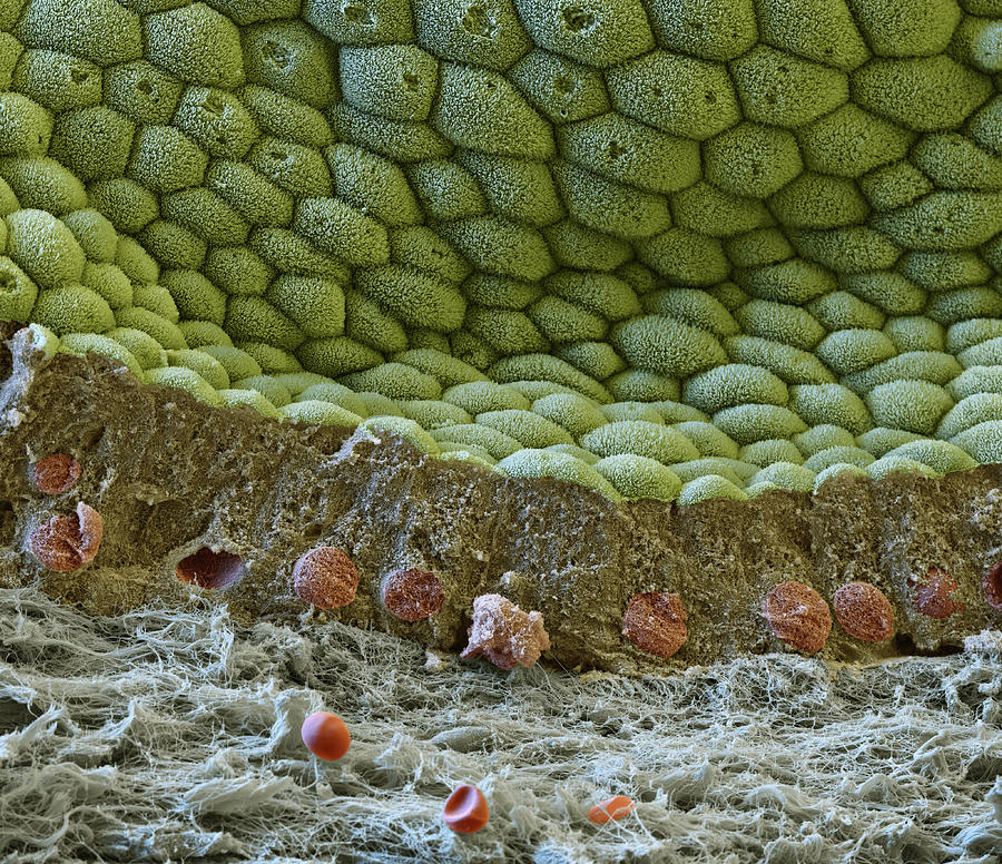 Gallbladder, Sem #5 Photograph by Eye Of Science