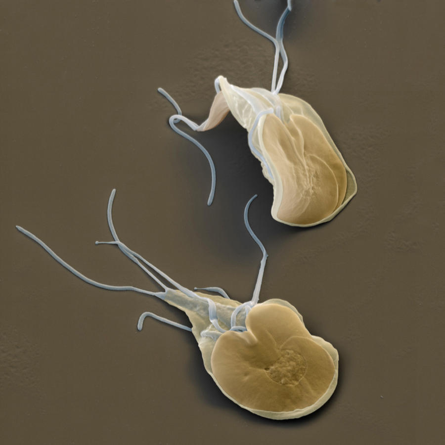 Giardia Lamblia Photograph by Eye of Science Fine Art America