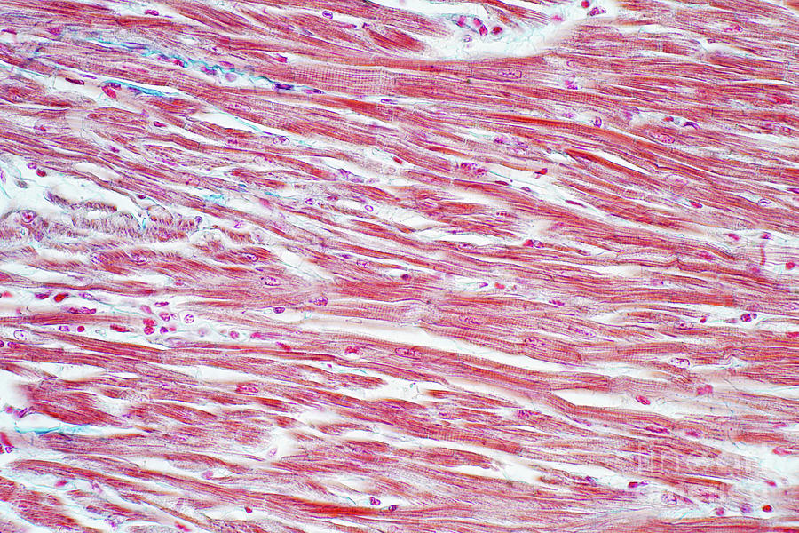 Human Cardiac Muscle Photograph by Choksawatdikorn / Science Photo ...