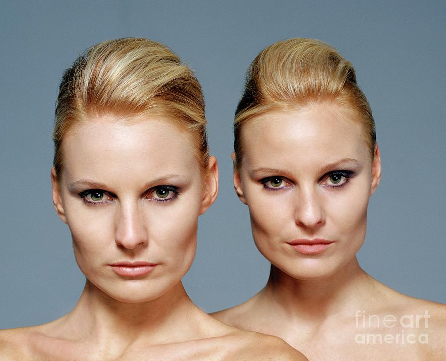 Biological Photograph - Identical Twin Sisters #5 by Kate Jacobs/science Photo Library