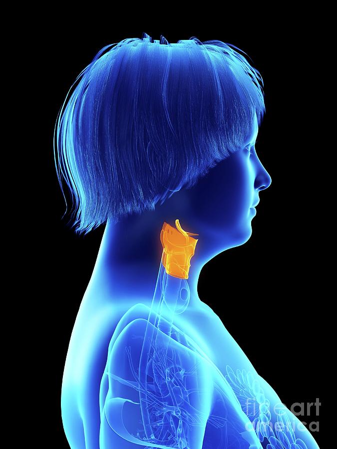 3d Photograph - Illustration Of An Obese Womans Larynx #5 by Sebastian Kaulitzki/science Photo Library