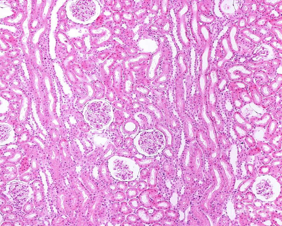 Kidney Cortex Photograph by Jose Calvo/science Photo Library - Fine Art ...