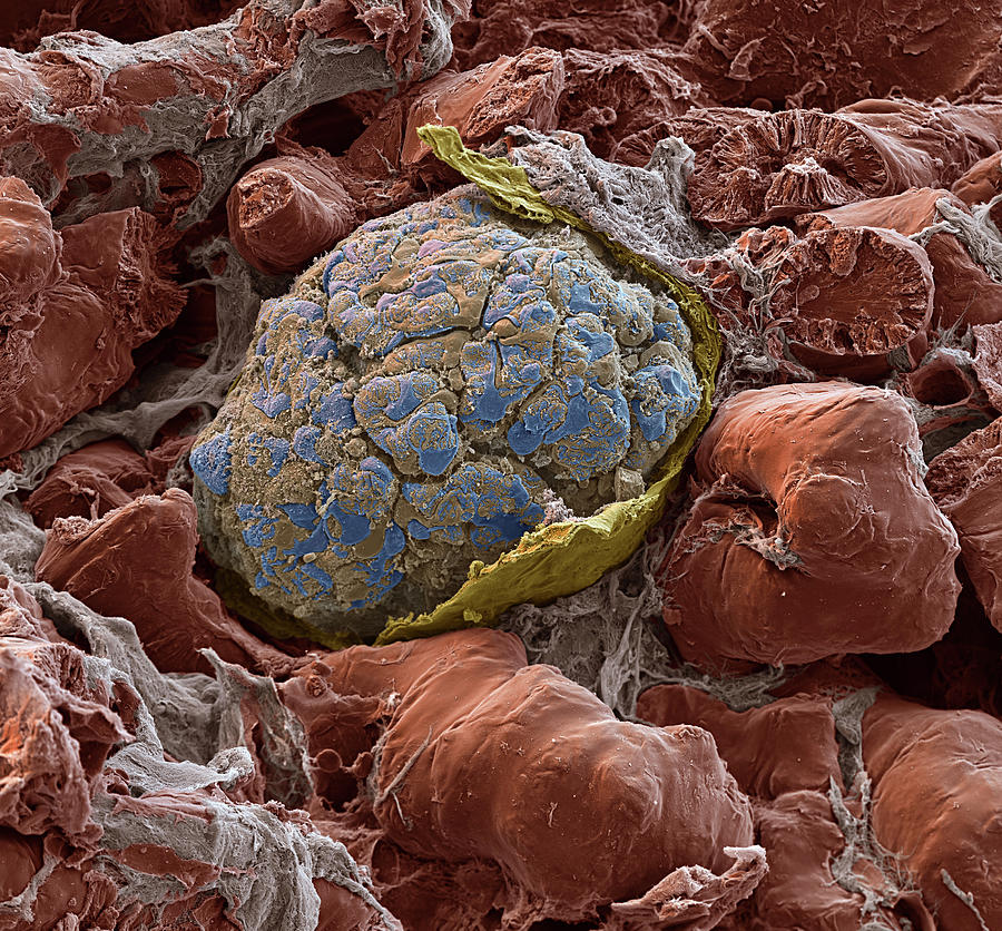 Kidney Glomerulus, Sem #5 Photograph by Oliver Meckes EYE OF SCIENCE