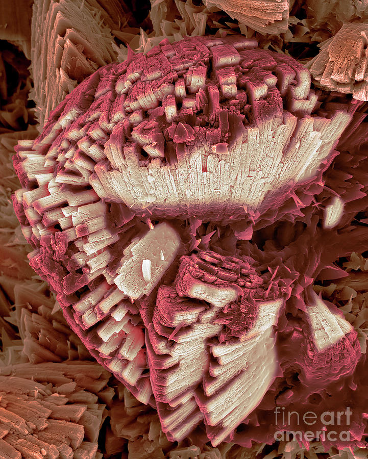 Kidney Stone #5 Photograph by Dennis Kunkel Microscopy/science Photo Library