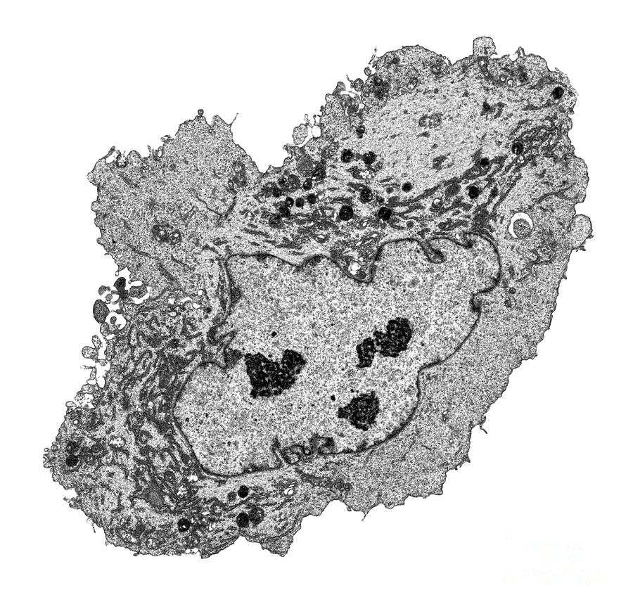 Lung Cancer Cell Photograph By Steve Gschmeissnerscience Photo Library