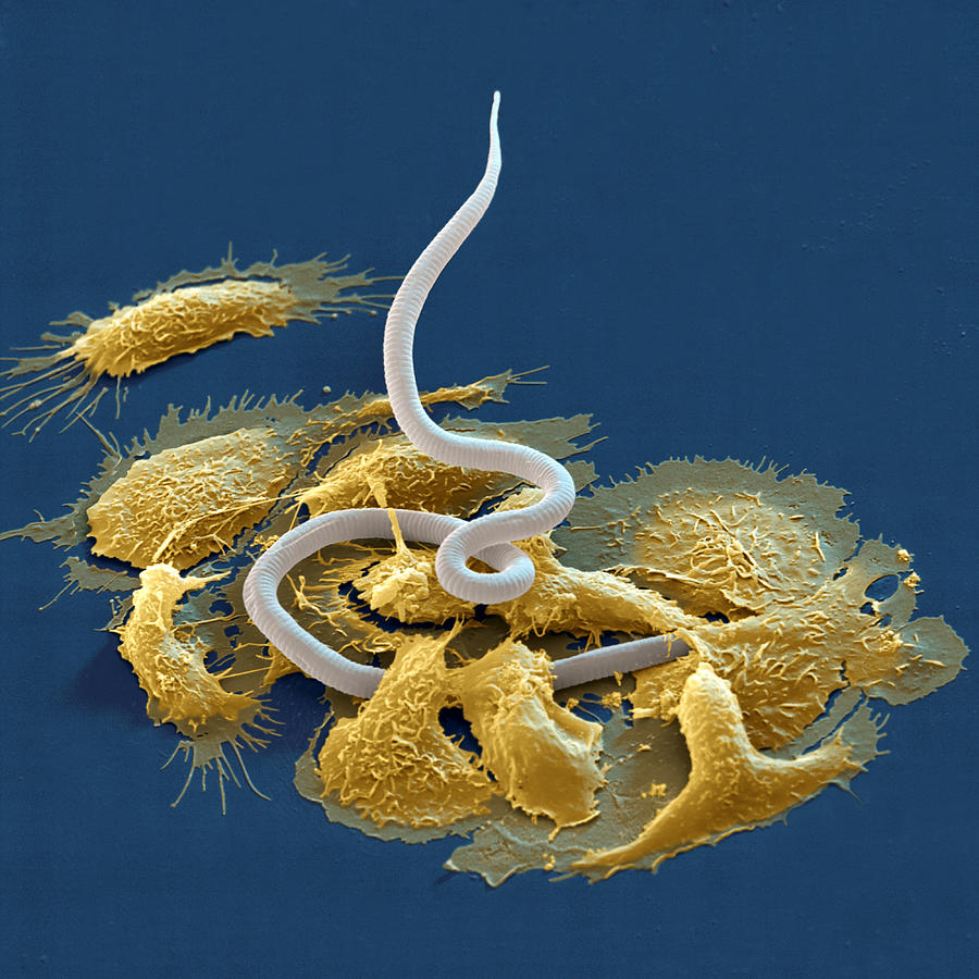 Macrophage And Microfilaria #5 Photograph by Meckes/ottawa