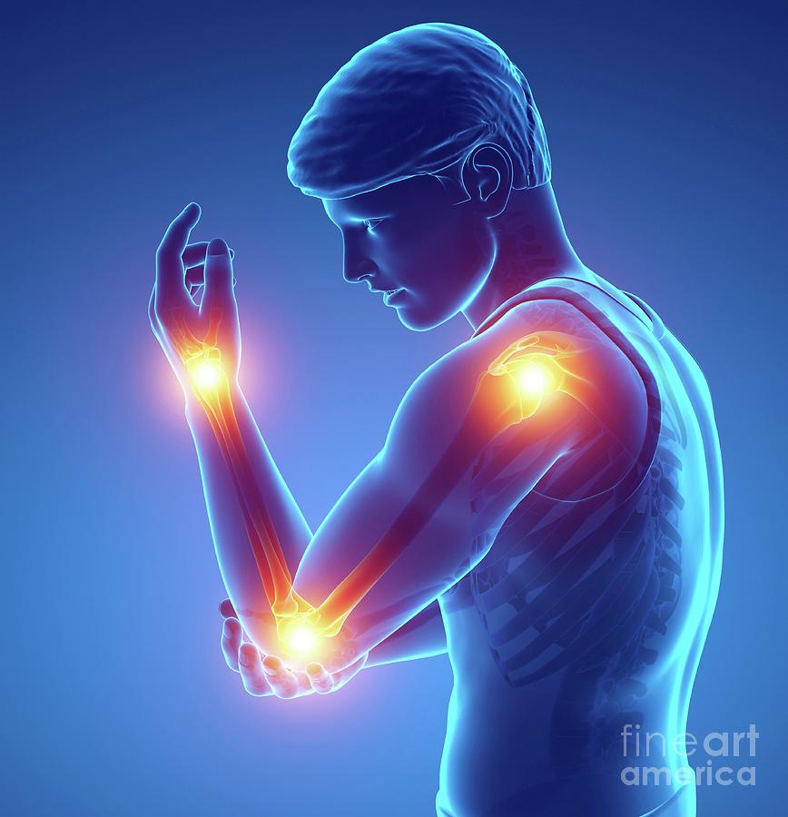 Man With Arm Pain Photograph by Pixologicstudio/science Photo Library ...