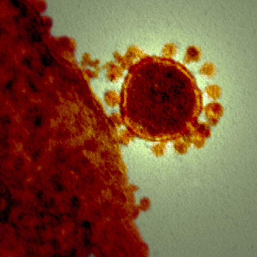 Mers Coronavirus, Tem #5 Photograph by Science Source