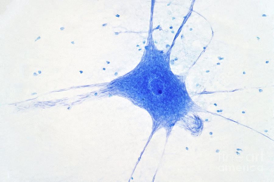 Nerve Cells #5 Photograph by Choksawatdikorn / Science Photo Library