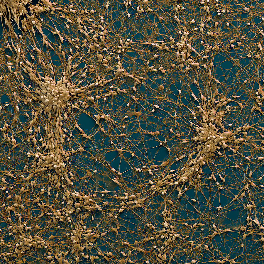 Neural Progenitor Cells Sem #5 Photograph by Meckes/ottawa