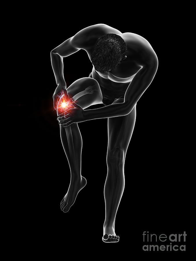 Painful Knee #5 Photograph by Sebastian Kaulitzki/science Photo Library