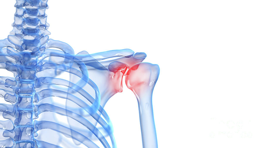 Painful Shoulder #5 Photograph by Sebastian Kaulitzki/science Photo Library
