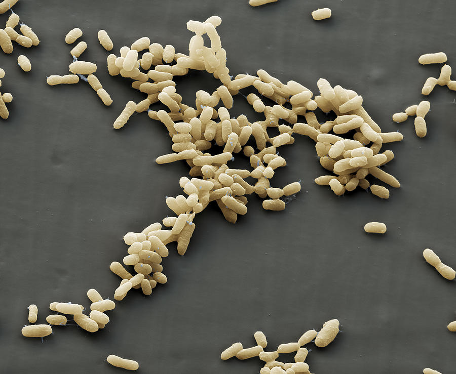 Plague Bacteria Yersinia Pestis, Sem #5 Photograph by Meckes/ottawa