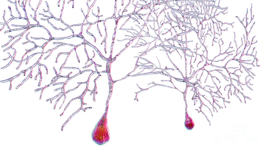 Purkinje Nerve Cells Photograph By Kateryna Kon Science Photo Library