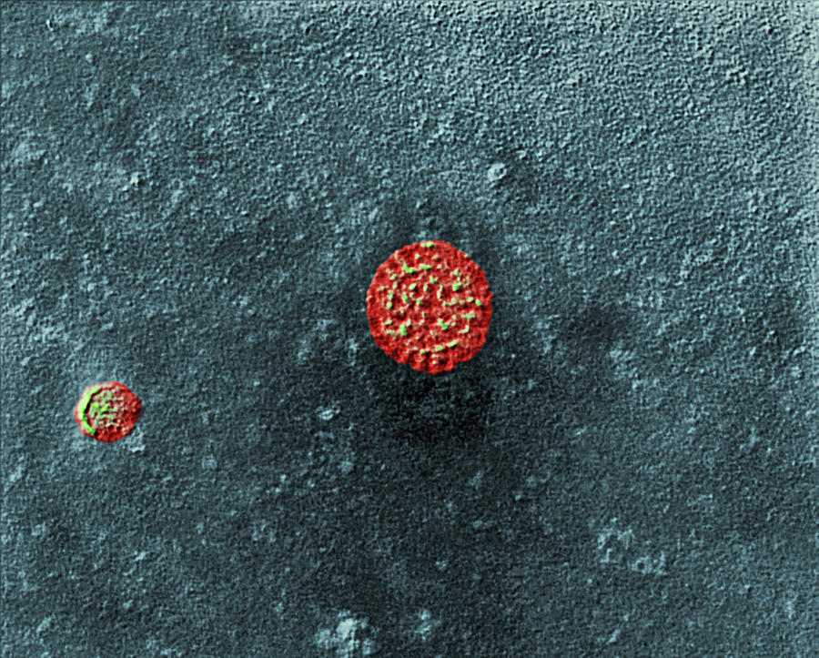 Rotavirus Particles, Tem #5 Photograph by Meckes/ottawa