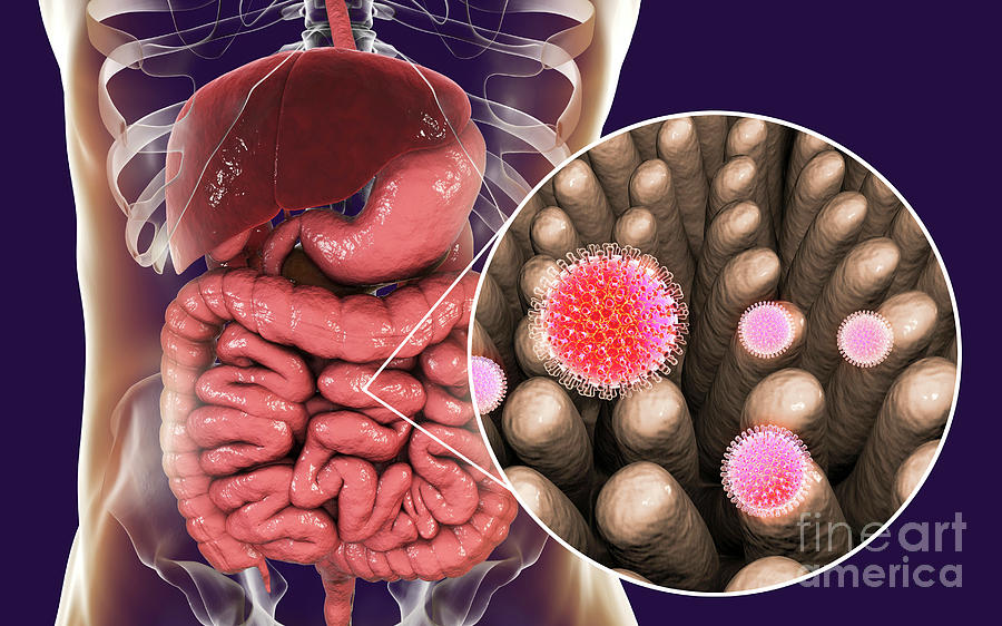 Rotaviruses Infecting Intestine Photograph by Kateryna Kon/science ...