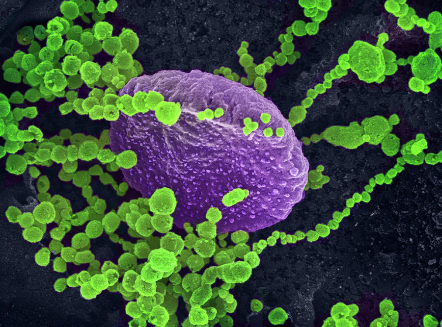 Sars-cov-2, Covid-19 Virus, Sem #5 Photograph by Science Source