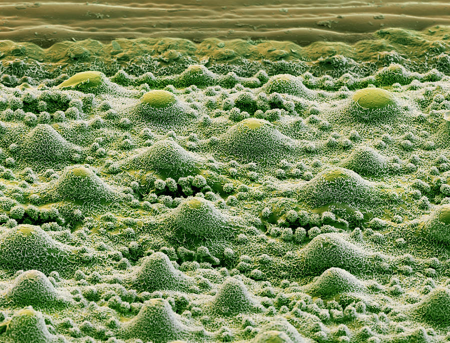 Section Of A Rice Leaf Sem #5 Photograph by Meckes/ottawa