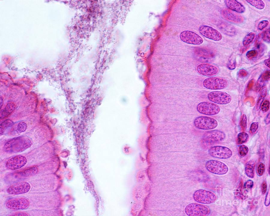 Simple Columnar Epithelium Photograph by Jose Calvo / Science Photo ...