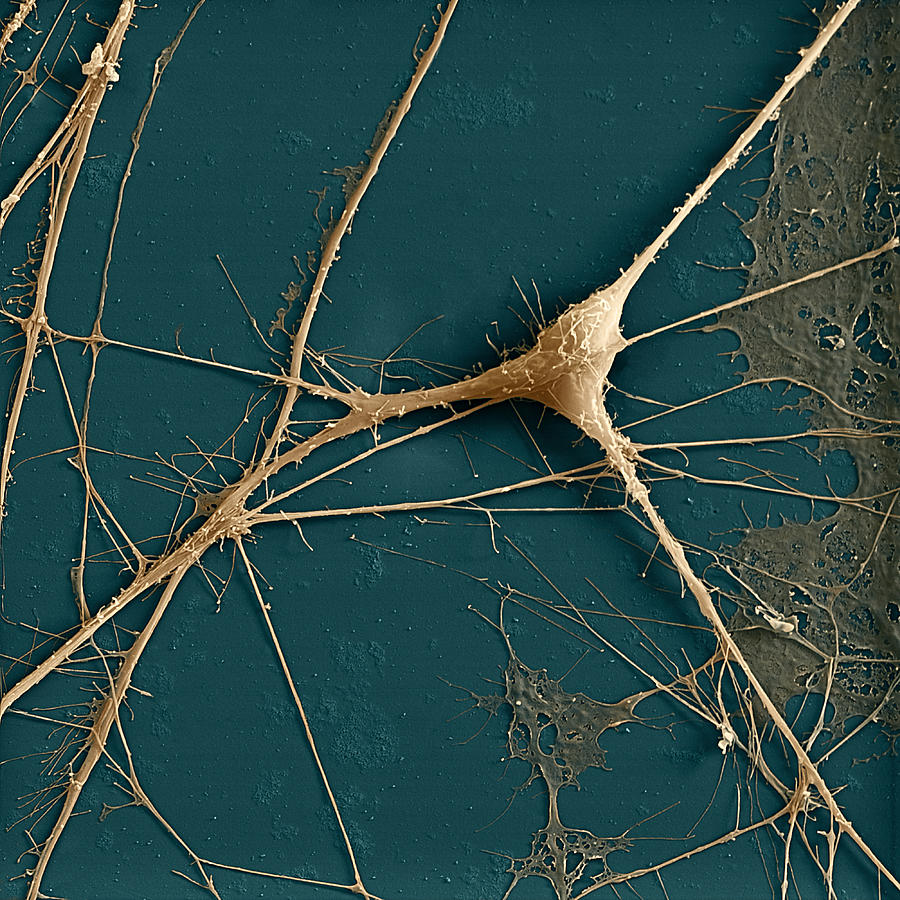 Spinal Ganglion Nerve Fibers Sem #5 Photograph by Meckes/ottawa