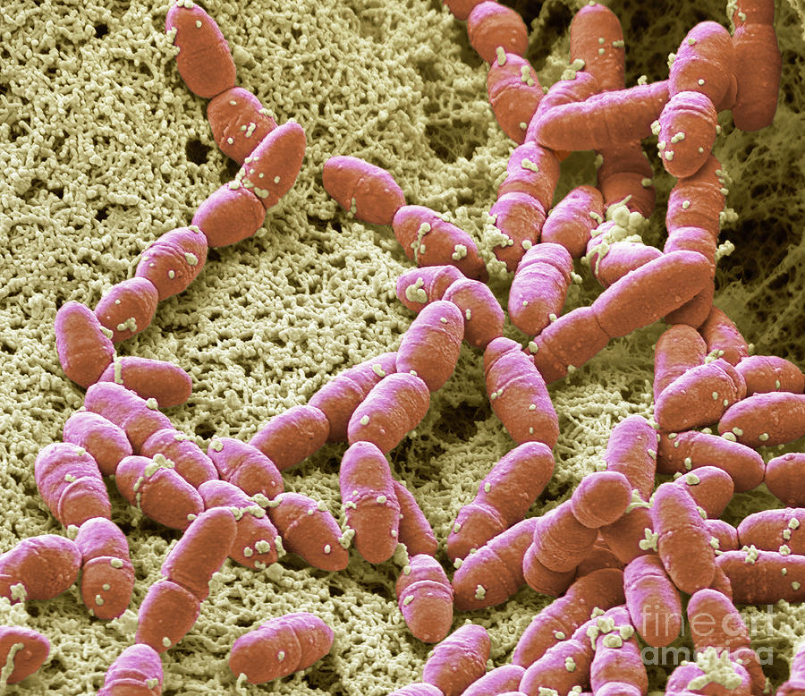 streptococcus-mutans-photograph-by-steve-gschmeissner-science-photo