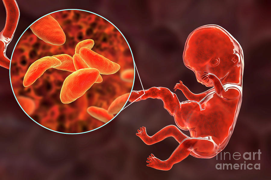 Transplacental Transmission Of Toxoplasmosis Photograph by Kateryna Kon
